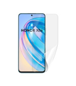 Screenshield HUAWEI Honor X8a fólie na displej