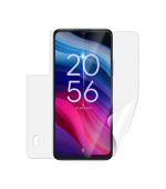Screenshield TCL 505 fólie na celé tělo