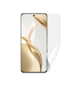 Screenshield HUAWEI Honor 200 fólie na displej